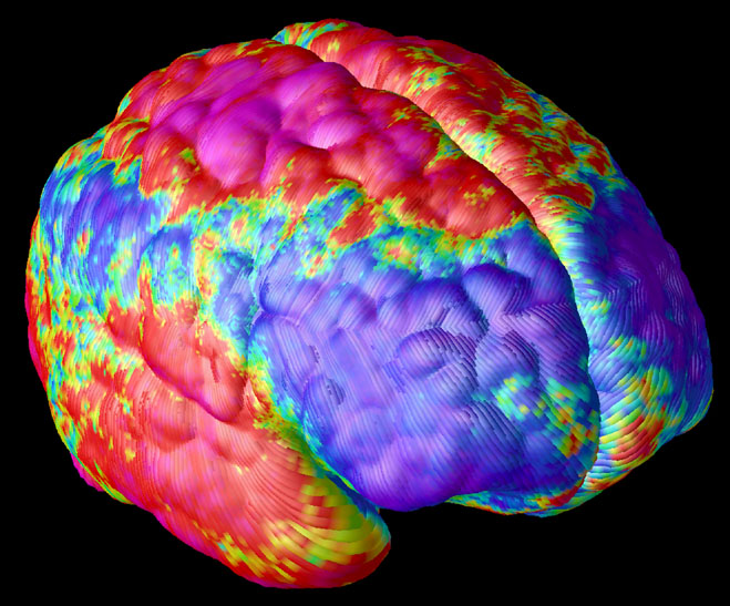 schizobrain.jpg